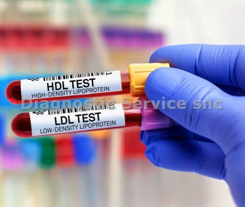 Direct LDL Cholesterol L 250 tests