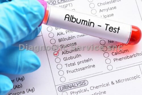 Albumin 2x250 ml