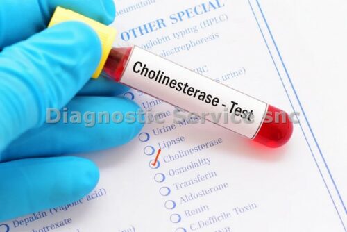 Cholinestérase 5x50 ml