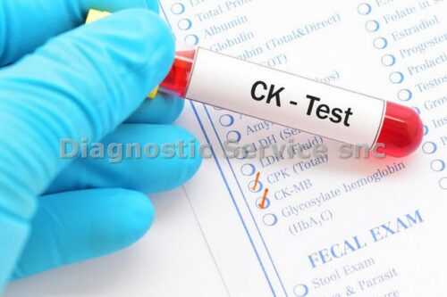 CK Nac 5x10 ml